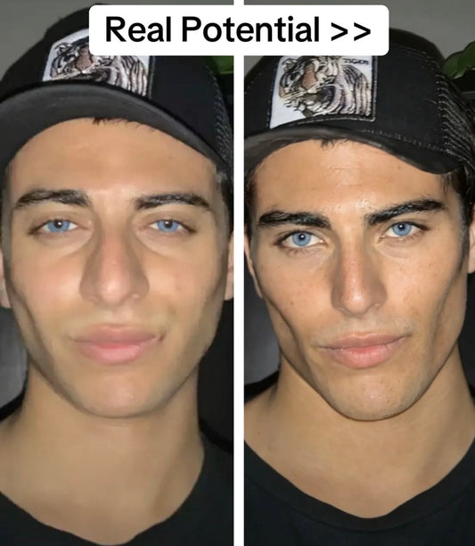 Facial Potential Projection (Morph)