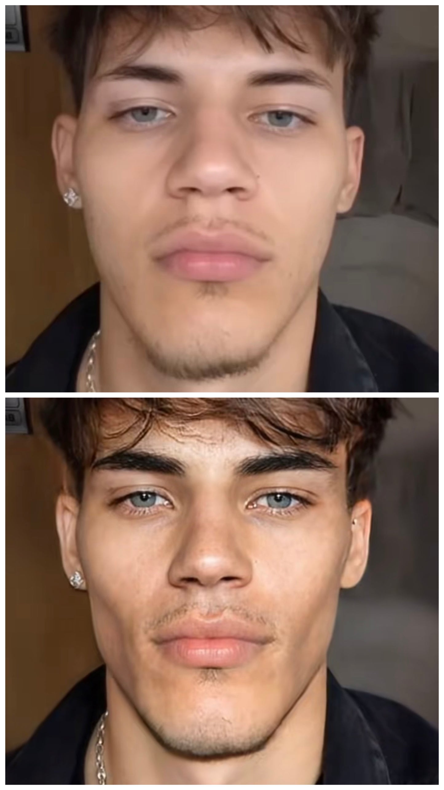 Facial Potential Projection (Morph)